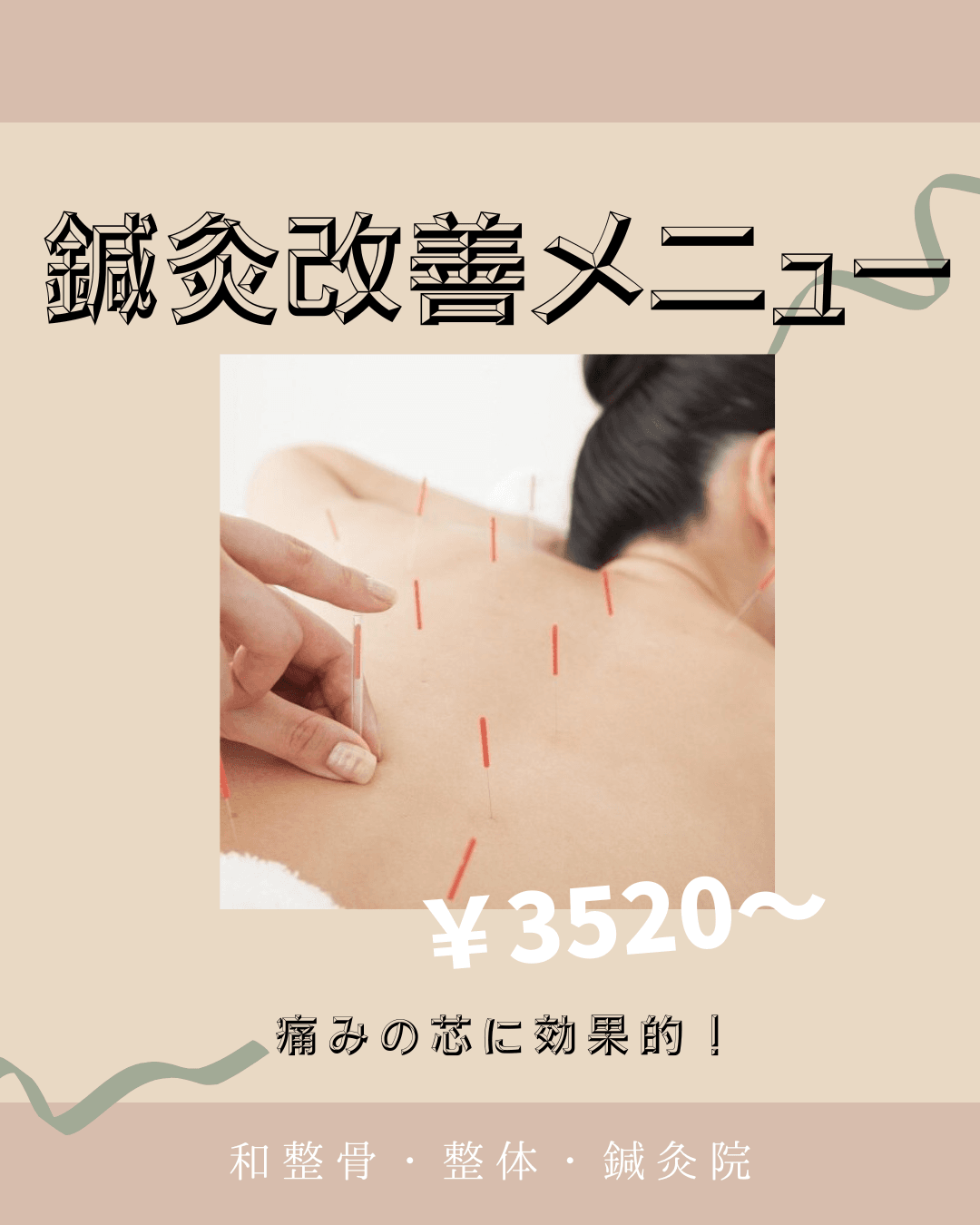 鍼灸治療 (1) (1).png